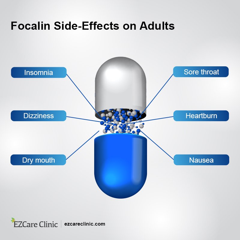 What You Need to Know About Focalin Side Effects - MEDvidi What You Need to Know About Focalin Side Effects - MEDvidi